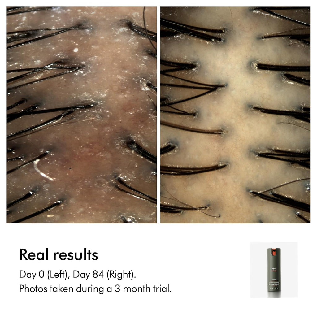 Dyson Amino™ Leave-In Scalp Bubble Treatment